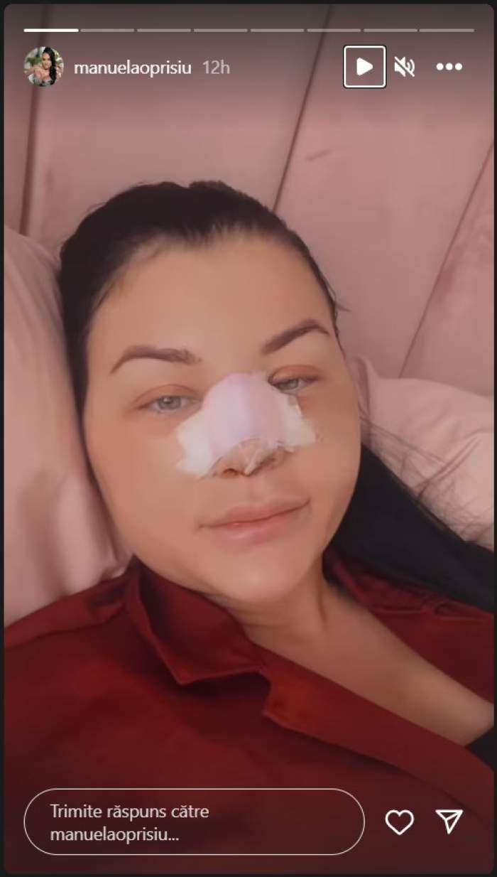 Cum se simte Manuela Oprișiu, după ce și-a operat nasul. Intervenția a avut loc în urmă cu câteva zile: „Starea de disconfort...” / FOTO
