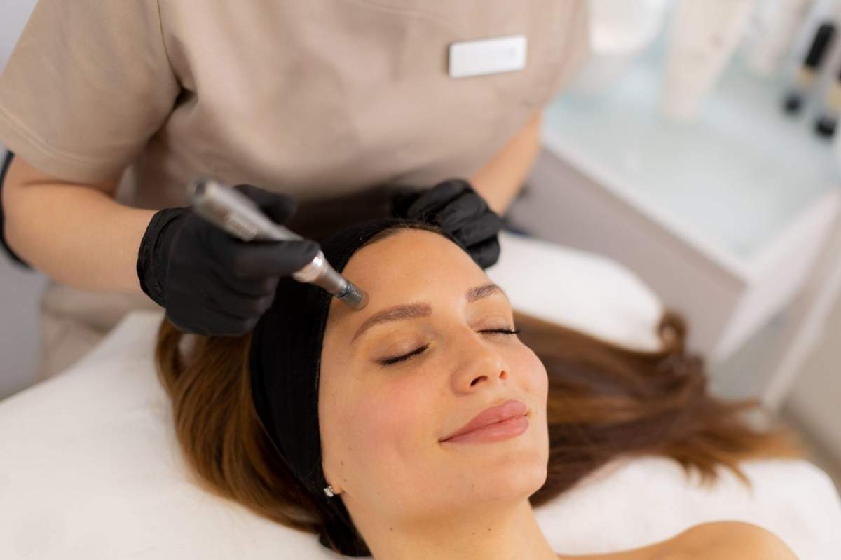 Un practician calificat efectuează microneedling pe un client relaxat