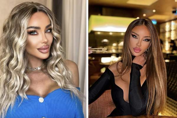 Xtra Night Show. Cine i-a fost alături Biancăi Drăgușanu, după intervenția estetică de care a avut parte. Bărbatul la care nimeni nu s-ar fi așteptat: „Am avut nevoie de încurajări” / VIDEO