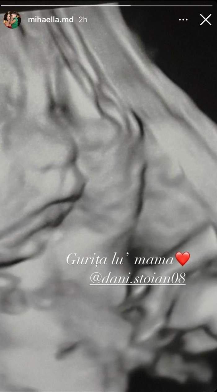 Soția lui Dani Stoian, fiul lui Florin Salam, prima imagine cu chipul bebelușului din burtică. Se pregătesc să devină părinți pentru a doua oară / FOTO