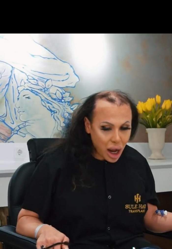 Sonia ferrari se confruntă cu alopecia