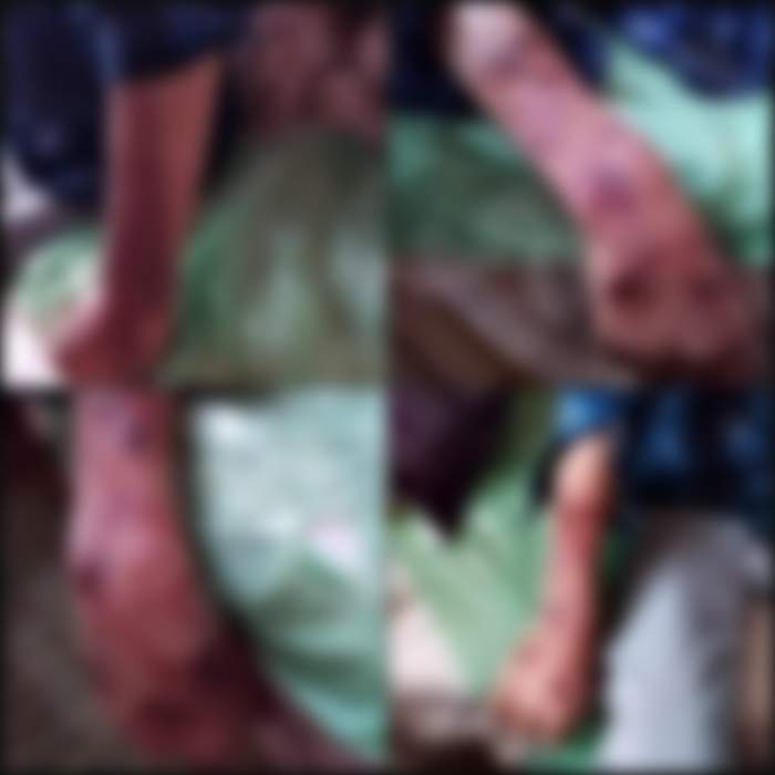 pacient legat de patul de spital