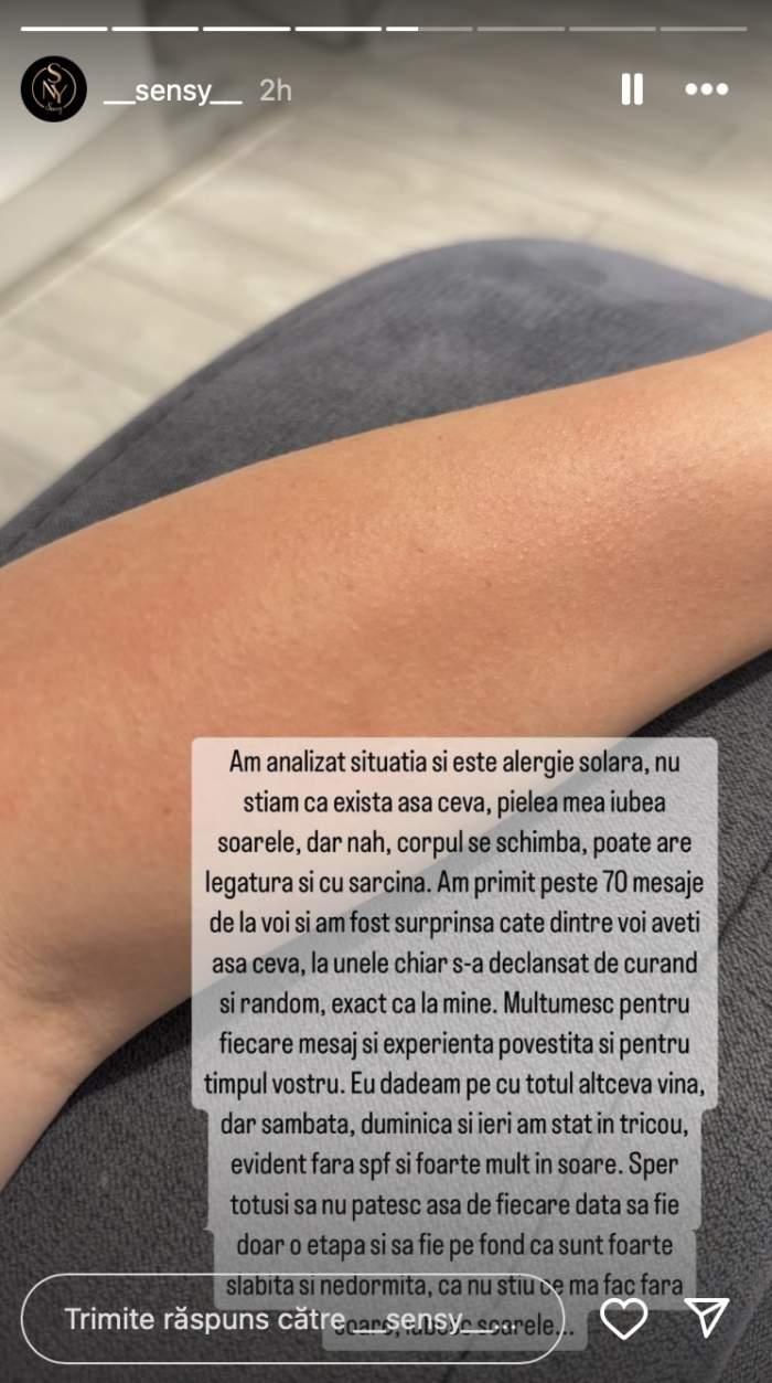 Cu ce problemă se confruntă Sensy: „Nu știam că există așa ceva”. Ce a pățit influencerița / FOTO