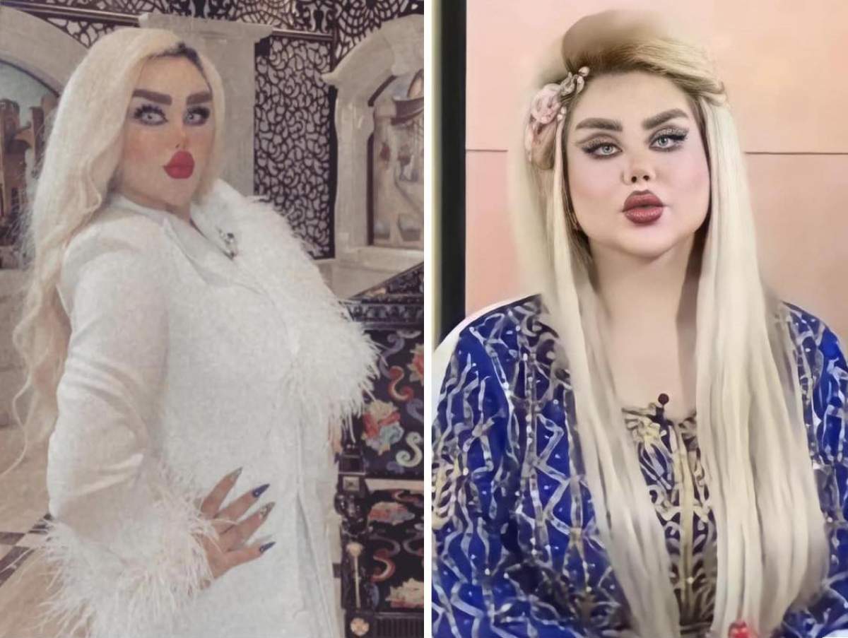 Colaj cu Dalia Naim după operațiile estetice, cu părul blond și ruj roșu Colaj cu Dalia Naim după operațiile estetice