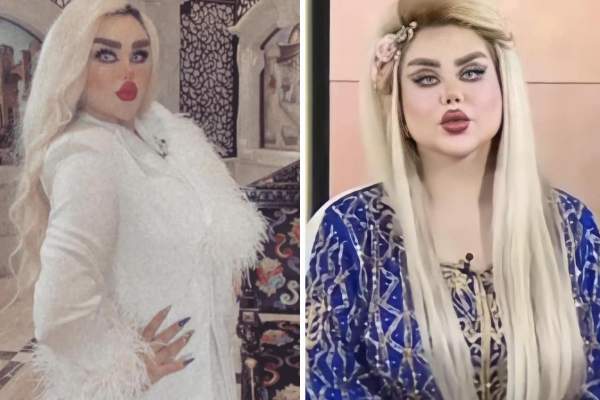 Știrile Antena Stars. O tânără și a făcut 43 de operații estetice pentru a arăta ca o păpușă! Cum arată după transformarea costisitoare  / VIDEO