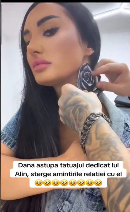 Dana Badea l-a dat uitării pe Alin după ce s-au despărțit. A șters definitiv tatuajul făcut pe când erau împreună. Cu ce l-a acoperit