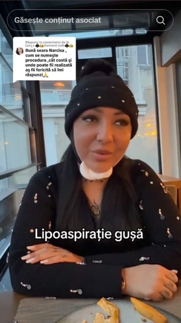 Narcisa Moisa, pe mâinile medicului estetician. Ce intervenție și-a făcut: „Nu prea am dormit bine”