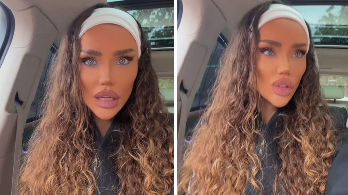 A revenit la buzele mici Bianca Drăgușanu și-a topit acidul hialuronic, din nou! Motivul pentru care a decis să revină la buze mici