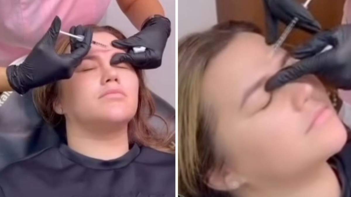 Ce intervenții și-a făcut Carmen de la Sălciua, pe mâna medicului estetician! La ce intervenții a apelat cântăreața