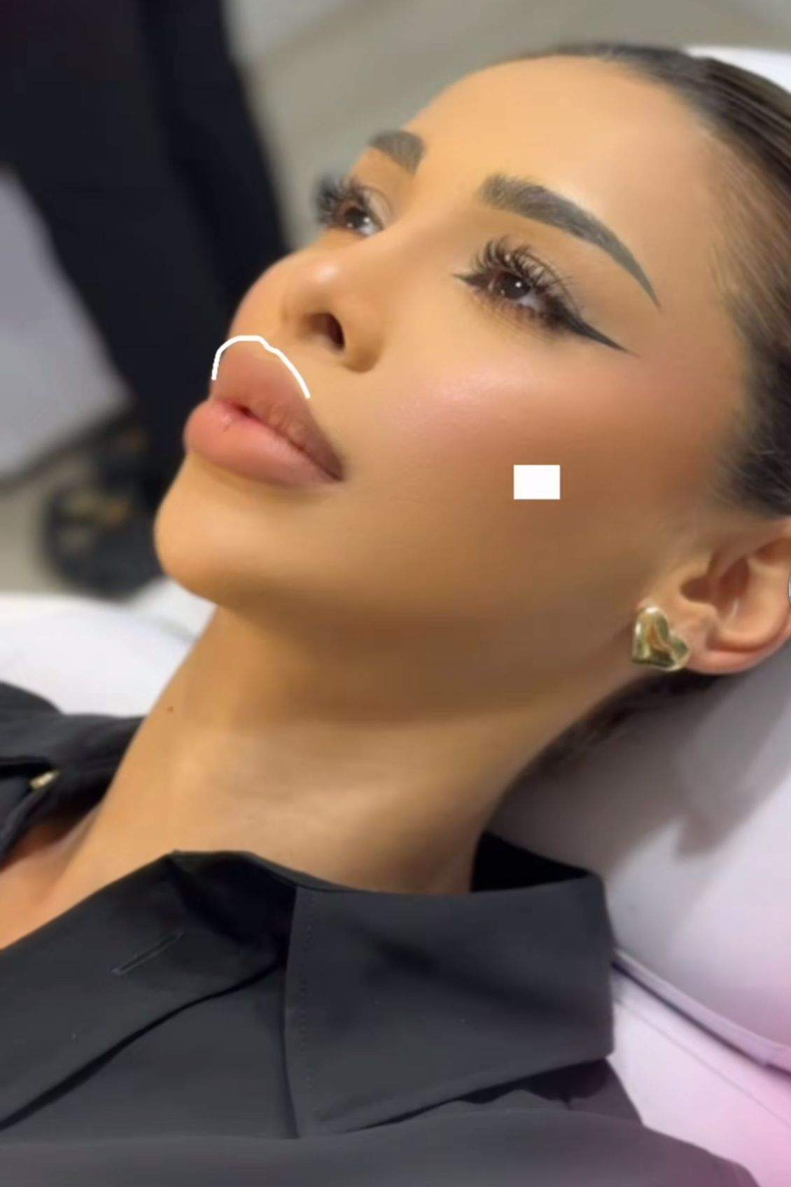 Cristina Pucean a ajuns pe mâna medicului estetician! La ce procedură a apelat iubita lui Bogdan de la Ploiești