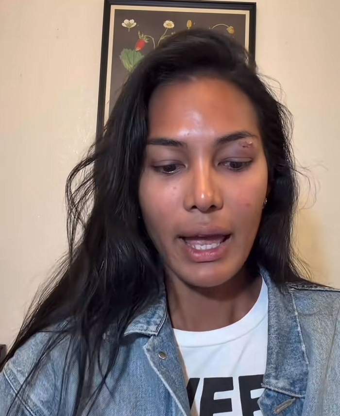 Influenceriță bătută pe stradă fără niciun motiv. A fost lovită în față în repetate rânduri de un străin