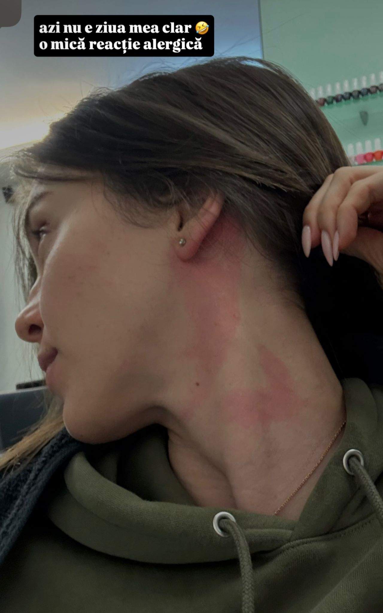 După ce s-a lovit la frunte, a cuprins-o o alergie Zi cu ghinion pentru Teodora Stoica. Ce i s-a întâmplat fiicei lui Meme Stoica: "Azi nu e ziua mea clar"