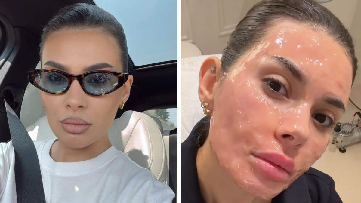 Marisa Paloma a luat o decizie îndrăzneață! Influencerița este acum de nerecunoscut, după ce și-a făcut o procedură la nivelul feței | FOTO