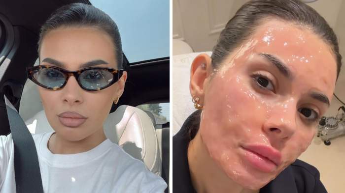 Marisa Paloma a luat o decizie îndrăzneață! Influencerița este acum de nerecunoscut, după ce și-a făcut o procedură la nivelul feței | FOTO