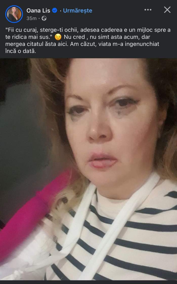 Oana Lis, postare șocantă pe rețelele de socializare