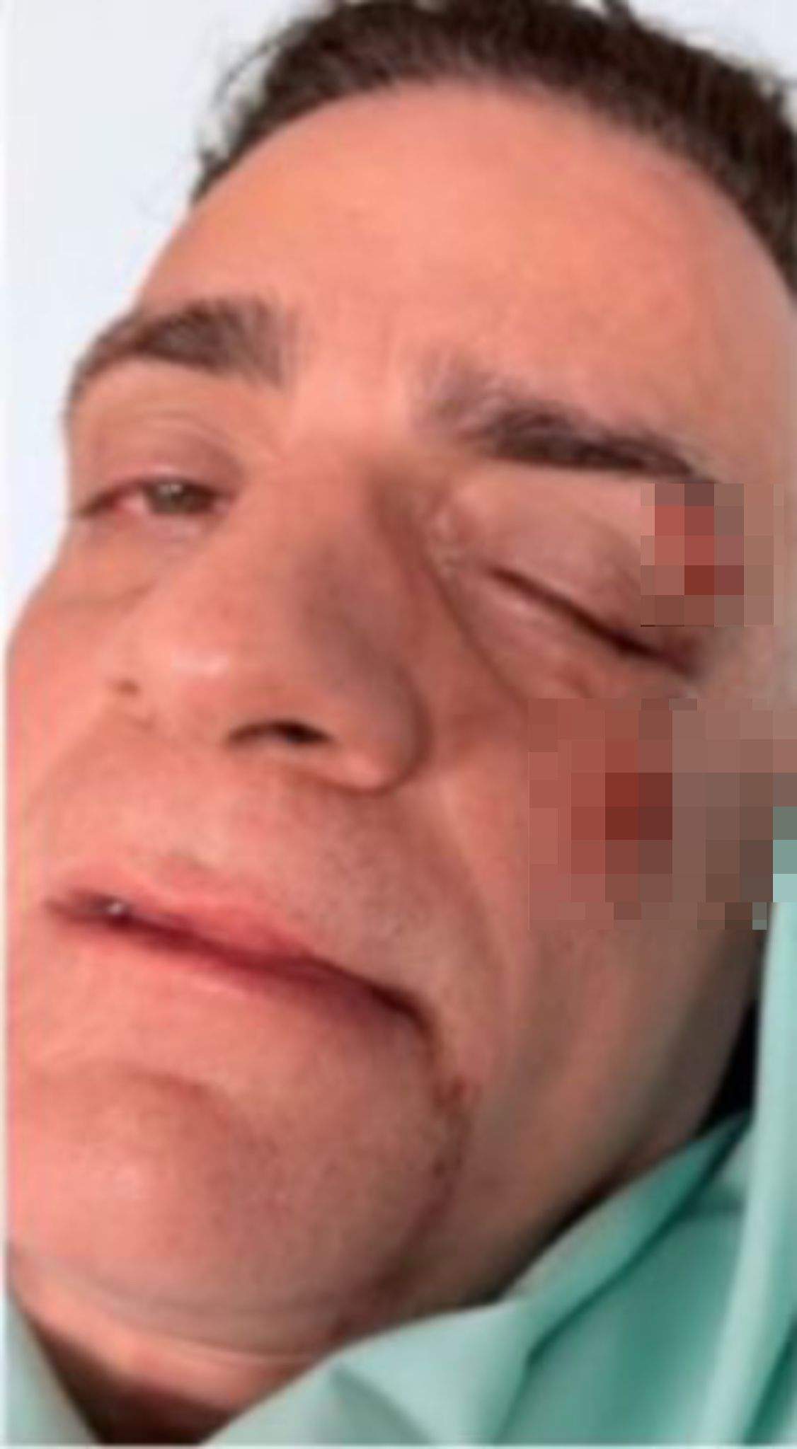 Simone Cicalone bătut