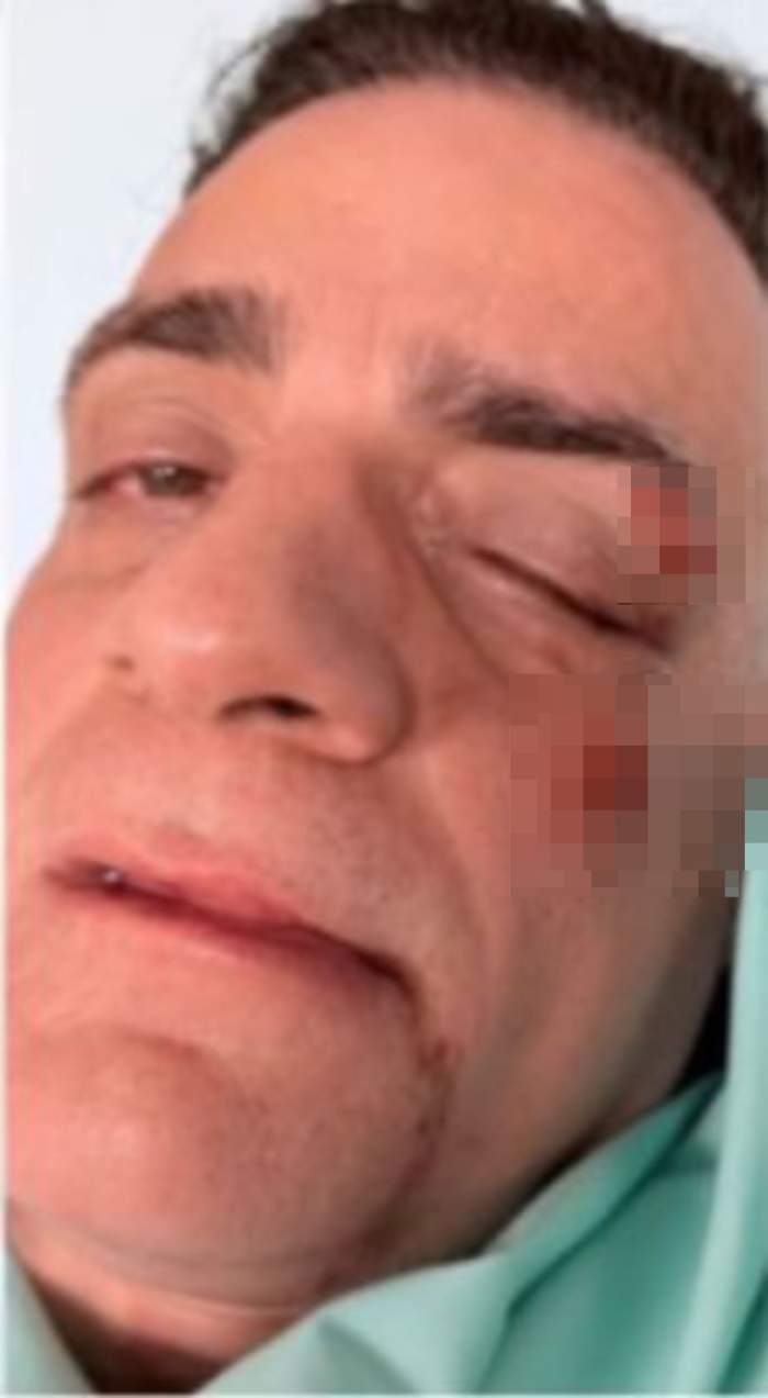 Simone Cicalone bătut