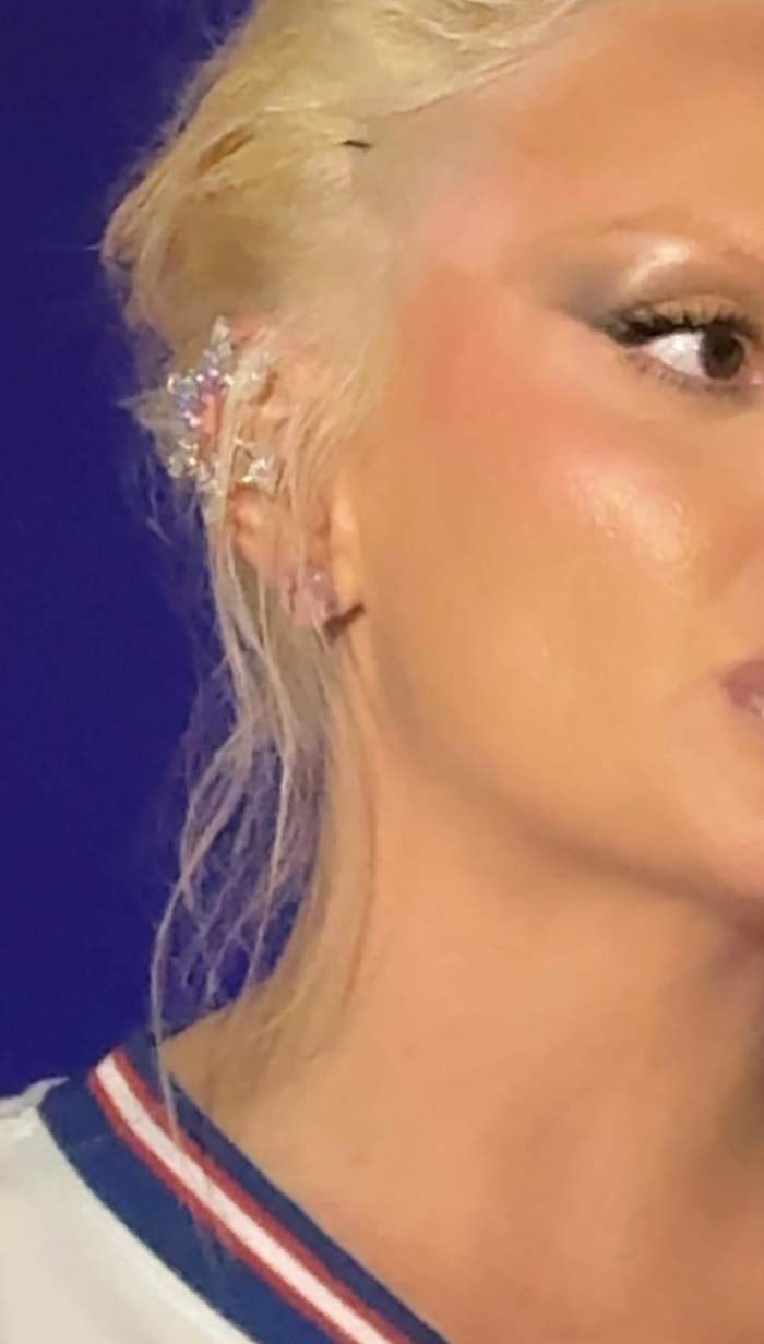 Alexandra Stan poarta benzi pentru lifting