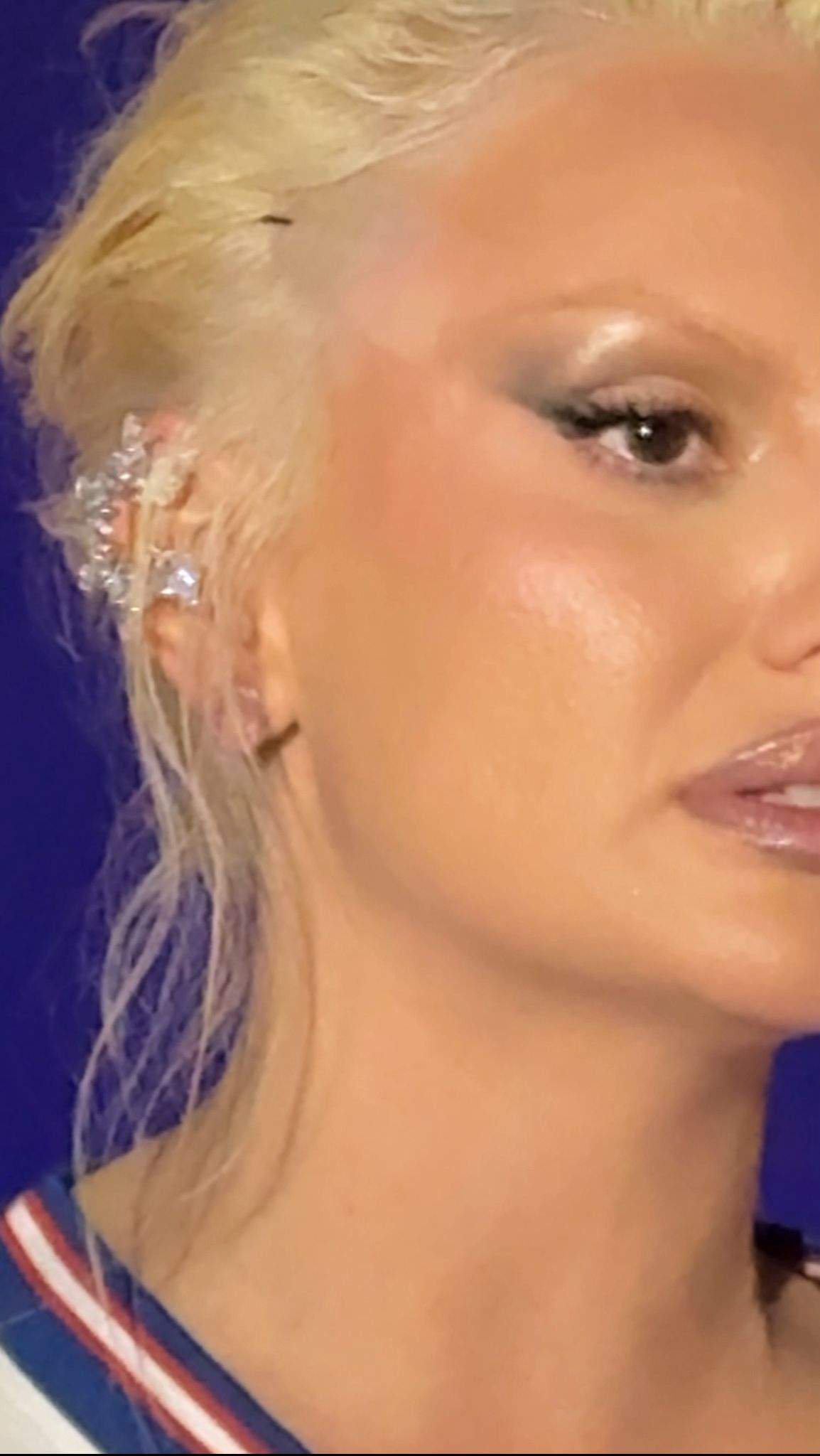 Alexandra Stan poarta benzi pentru lifting