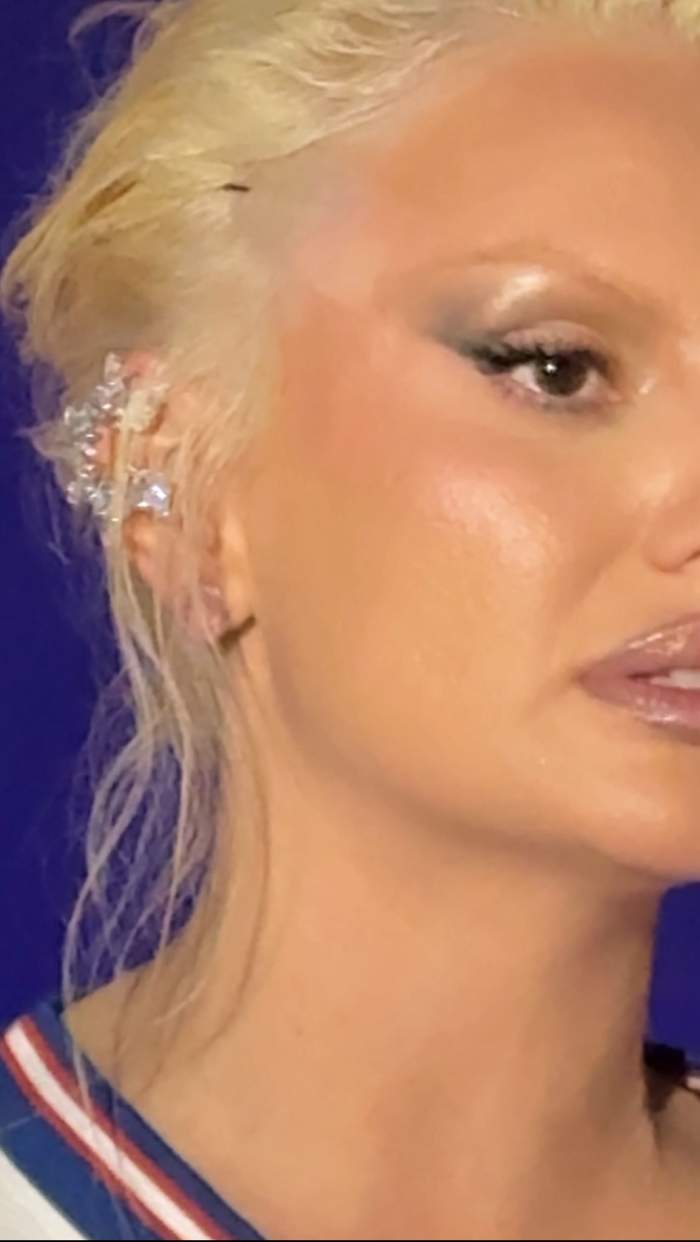 Alexandra Stan poarta benzi pentru lifting