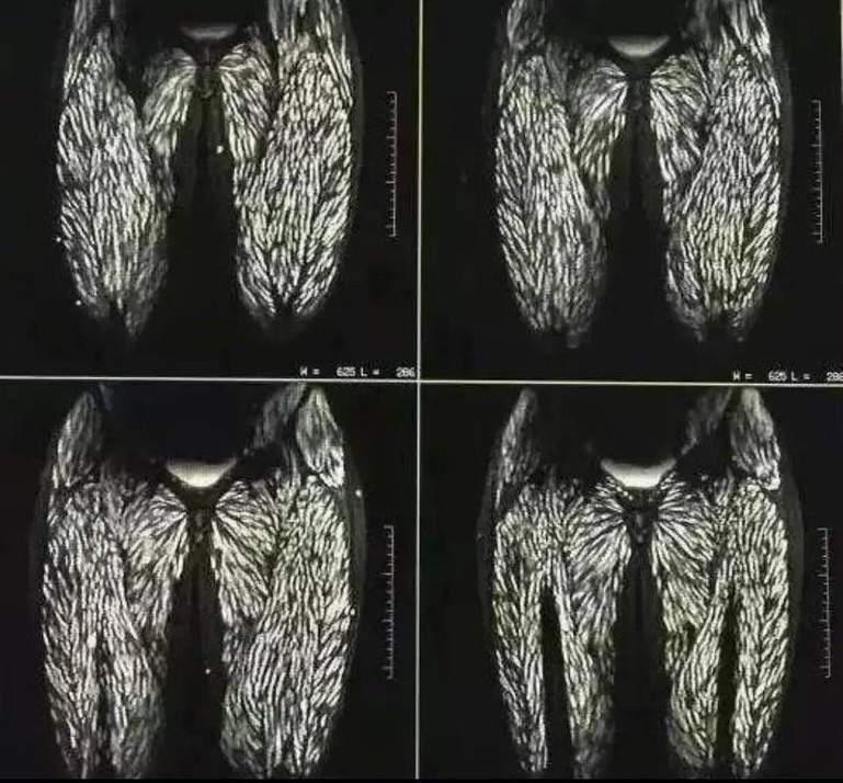 Radiografia unei femei