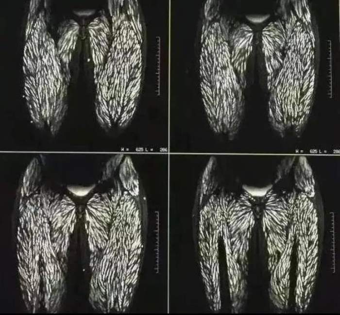 Radiografia unei femei