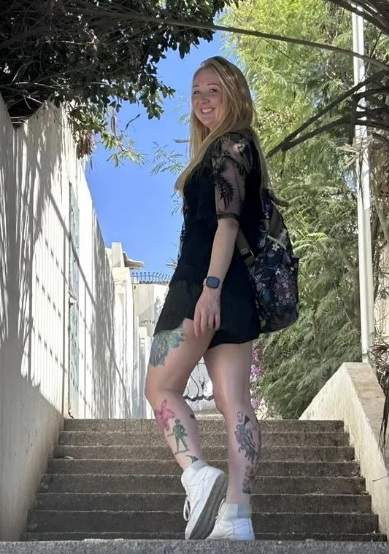 O femeie a fost diagnosticată cu cancer de piele după ce a mers la solar. A avut nevoie de 13 operații