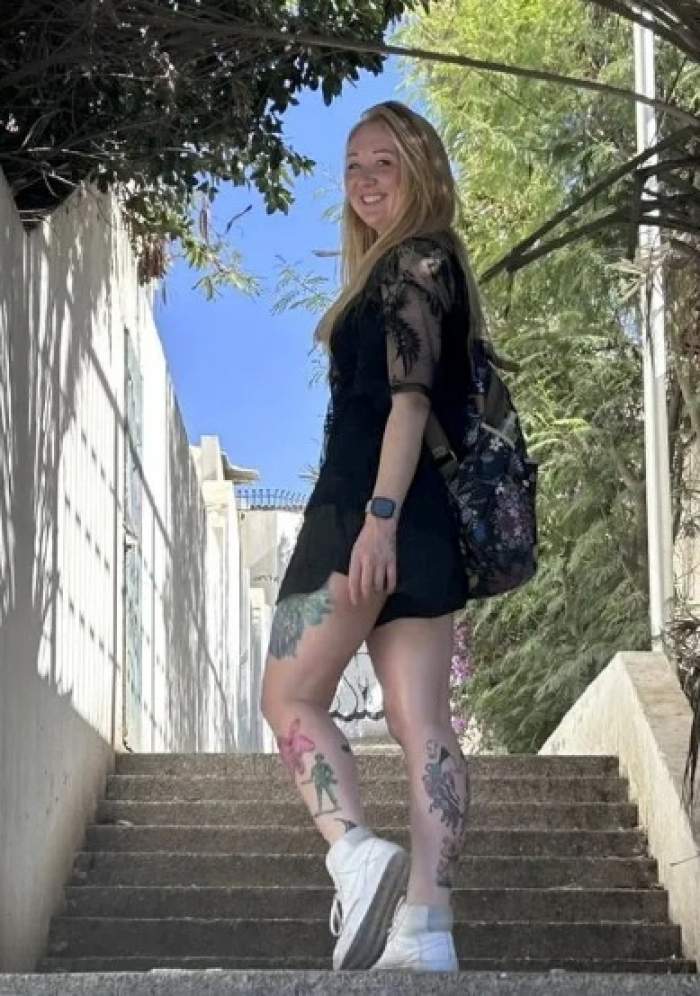 O femeie a fost diagnosticată cu cancer de piele după ce a mers la solar. A avut nevoie de 13 operații