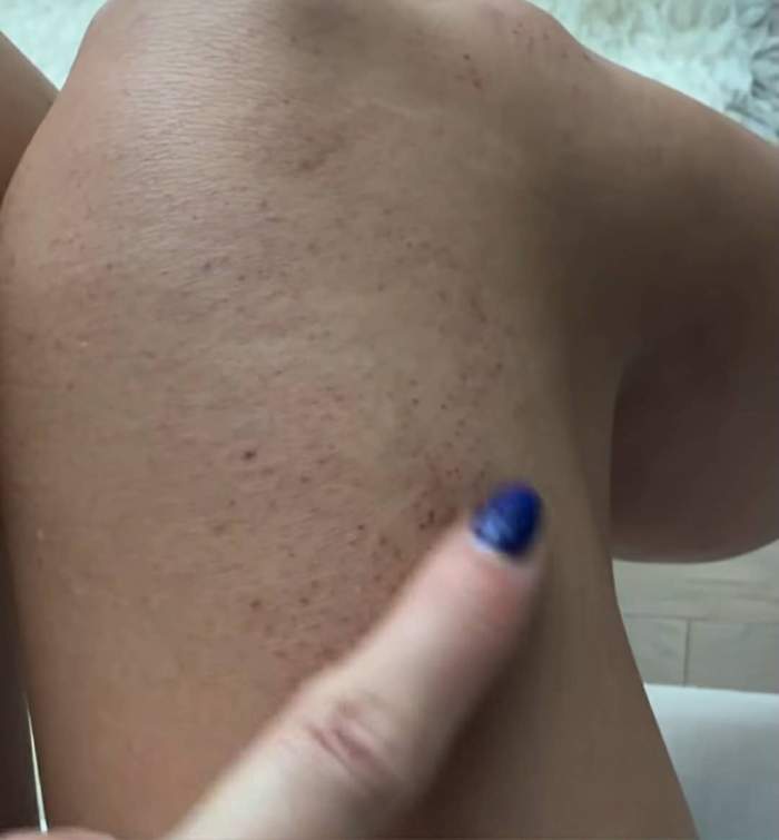 piciorul Alinei Pușcaș