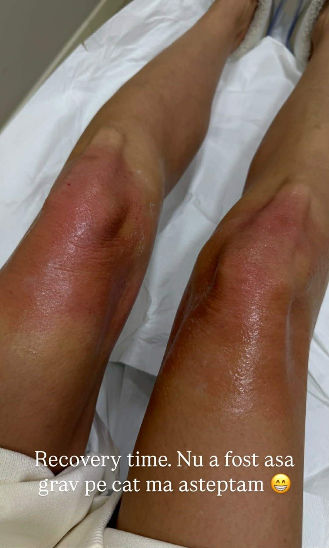 picioarele Alinei Pușcaș