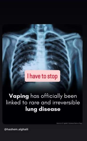 Panică în familia vedetei Katie Price! A publicat o radiografie care a speriat pe toată lumea: "Boală pulmonară rară și ireversibilă"