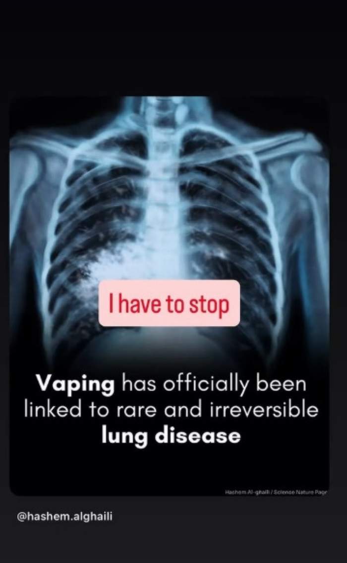 Panică în familia vedetei Katie Price! A publicat o radiografie care a speriat pe toată lumea: "Boală pulmonară rară și ireversibilă"