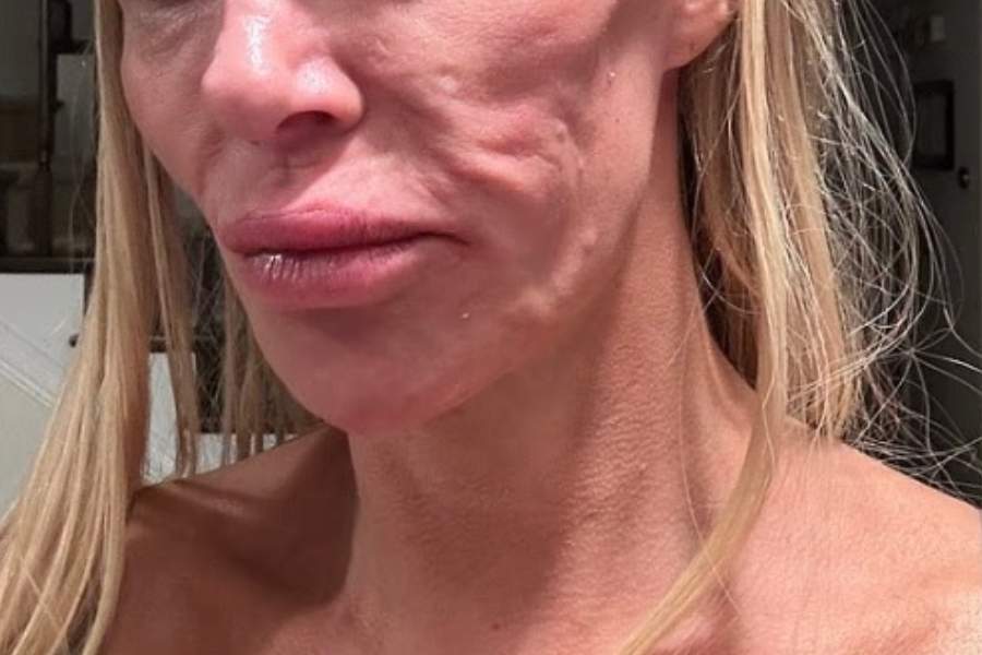 O vedetă TV a aflat de ce are fața distrusă! Inițial a crezut că era vorba de un parazit