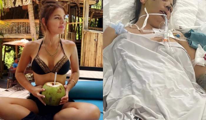 O femeie se află în stare gravă după o intervenție estetică simplă. Este ținută în viață de aparate