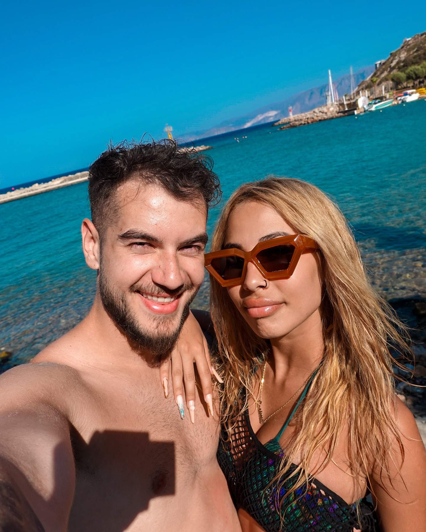 Apariția cu care foștii concurenți de la Power Couple și-au îngrijorat fanii. Ce au pățit Cesima și Theo Zeciu / FOTO