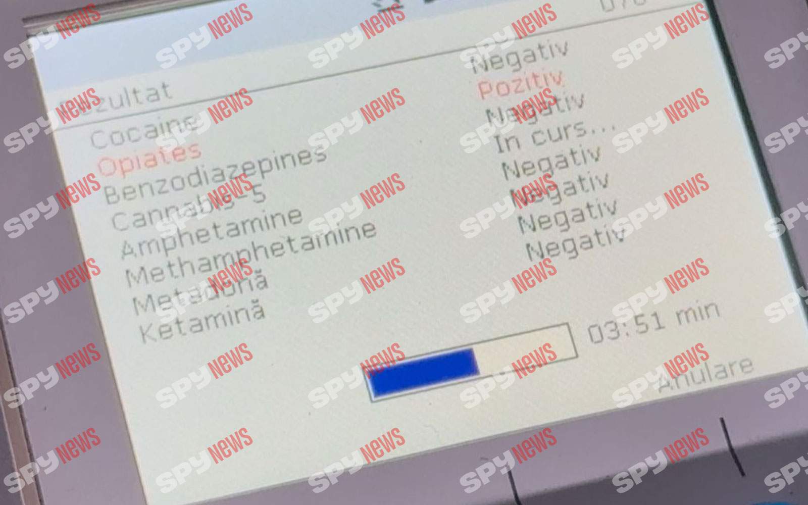 BREAKING NEWS! Jador a fost oprit in trafic de poliție! Cântărețul a ieșit pozitiv la test! Ar fi consumat opiacee | VIDEO