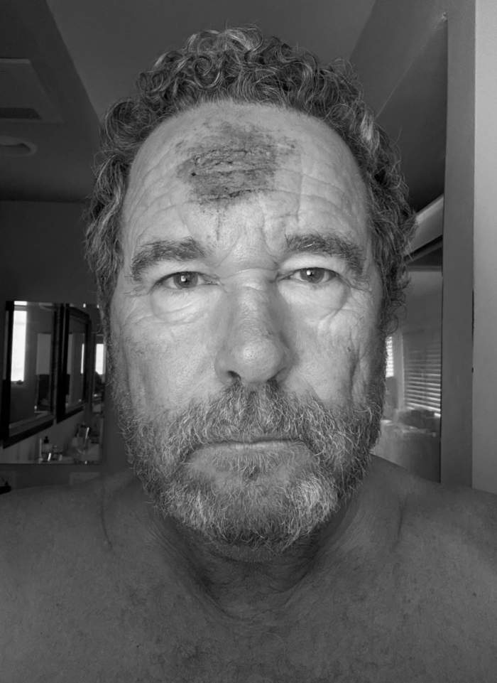 Imagini cutremurătoare au surprins momentul în care poliția californiană l-a împușcat în cap pe fotograful veteran Toby Canham cu un glonț de cauciuc în timpul protestului violent din Los Angeles de duminică seara
