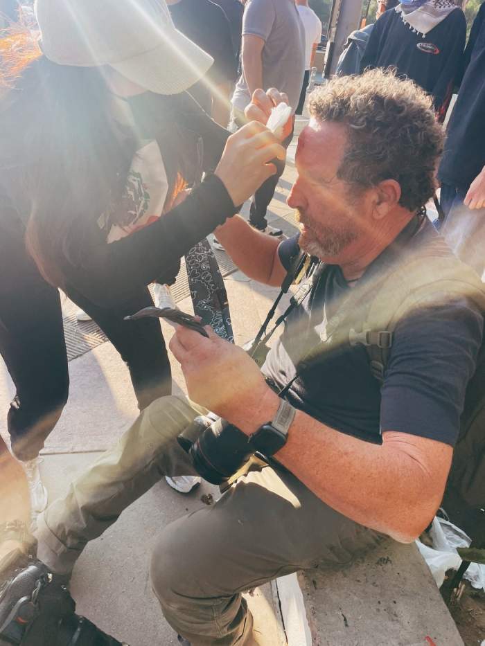 Imagini cutremurătoare au surprins momentul în care poliția californiană l-a împușcat în cap pe fotograful veteran Toby Canham cu un glonț de cauciuc în timpul protestului violent din Los Angeles de duminică seara