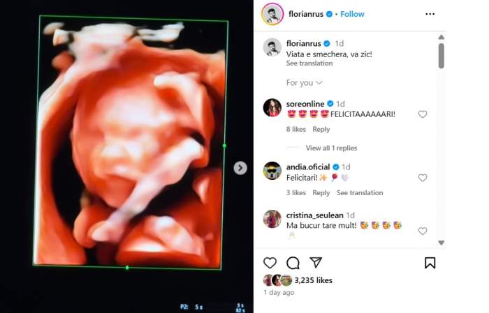 Florian Rus urmează să devină tată pentru prima dată! Artistul e în culmea fericirii / VIDEO