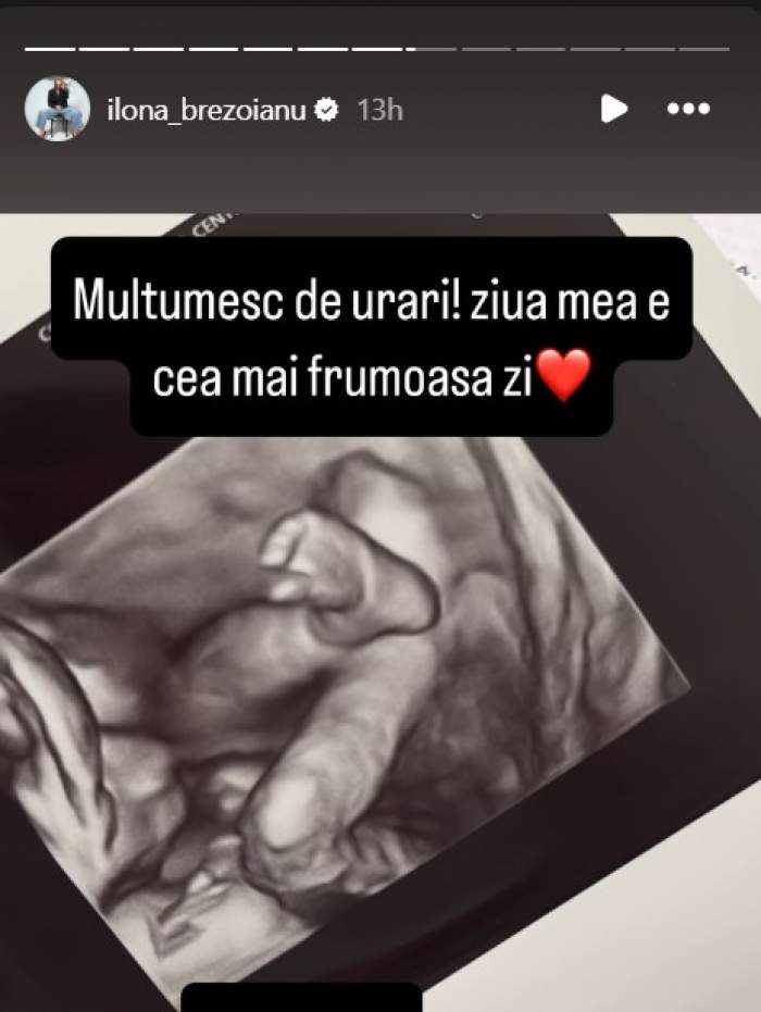 ilona brezoianu ecografie copil