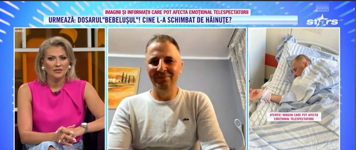 acces direct