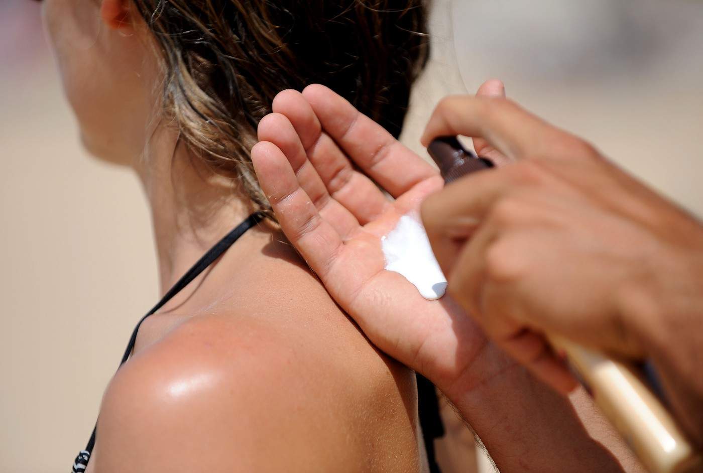 Cum să tratezi arsurile solare. Vei putea continua vacanța datorită unor remedii simple