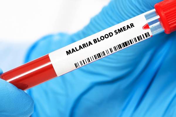 România, în fața unui potențial focar de malarie. Avertismentul de ultimă oră al medicilor de la spitalul "Victor Babeş": "Considerăm că este posibil"