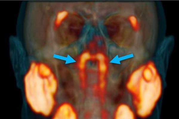 Descoperire surprinzătoare. Oamenii de știință au identificat glande salivare despre care nimeni nu știa  până acum