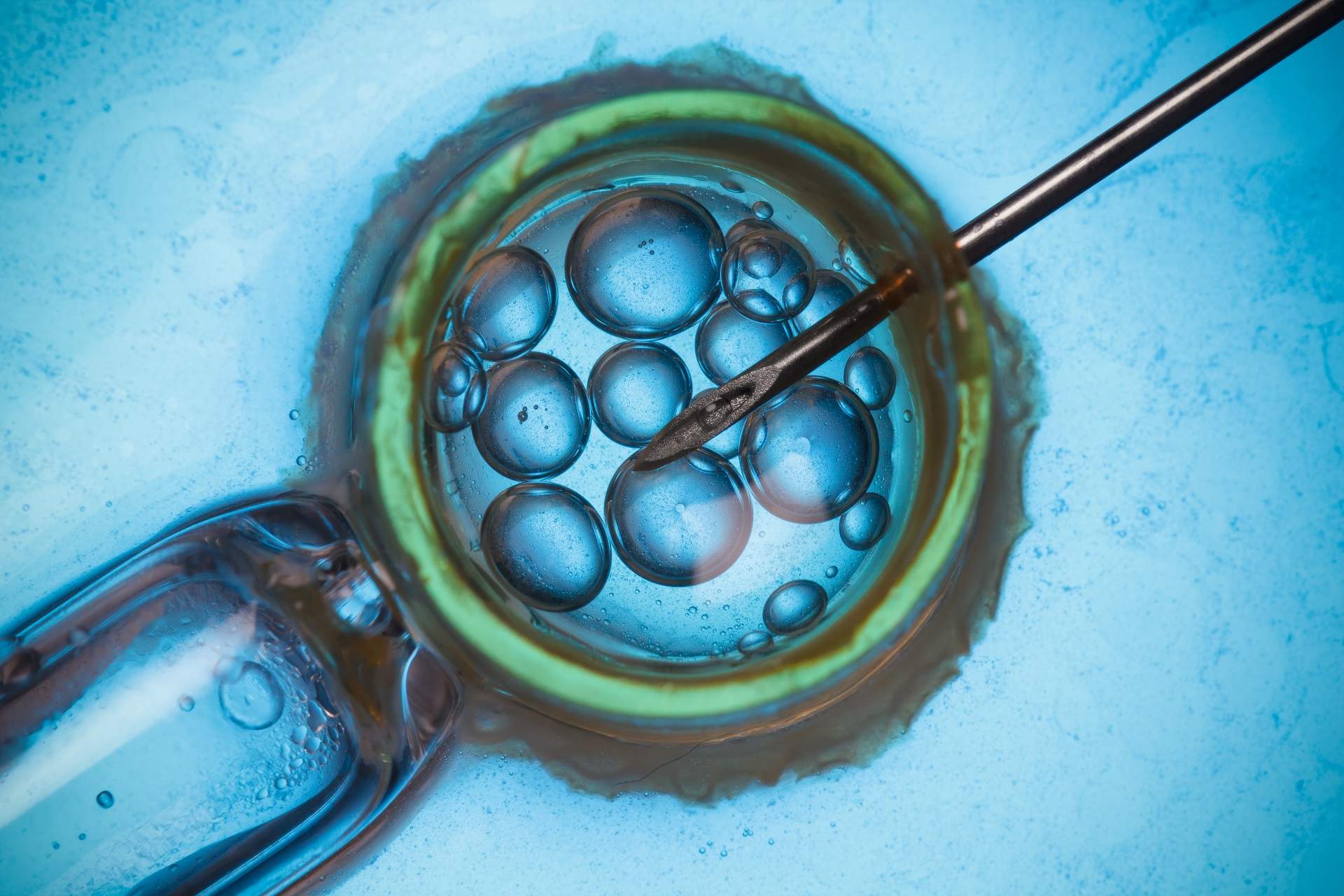 (P) Cum să crești eficiența tratamentului de fertilizare in vitro (FIV)