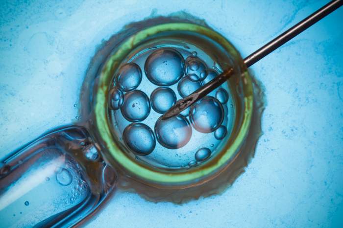 (P) Cum să crești eficiența tratamentului de fertilizare in vitro (FIV)