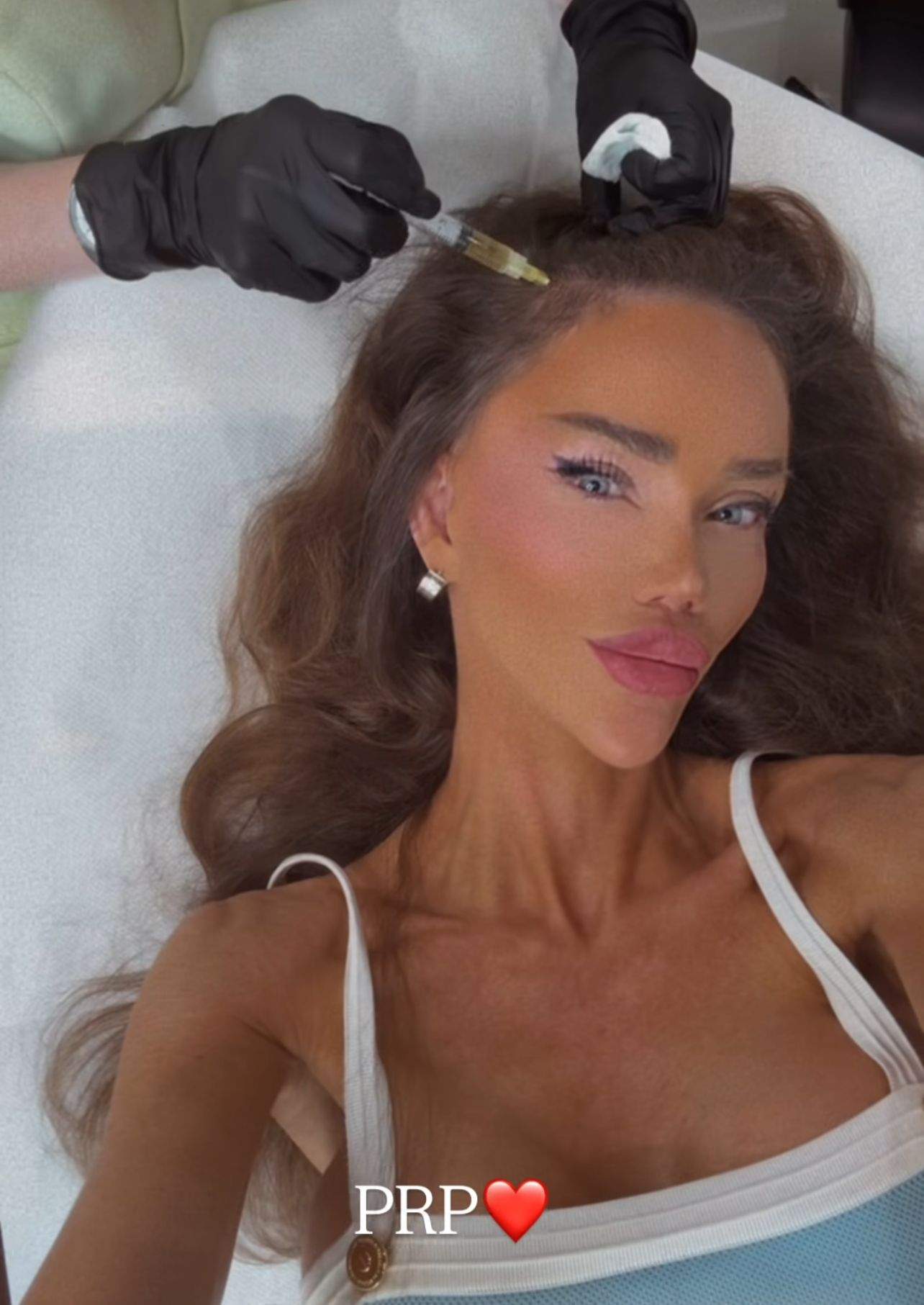 Bianca Drăgușanu bifează încă o intervenție estetică. La ce servicii a apelat vedeta de data aceasta | FOTO