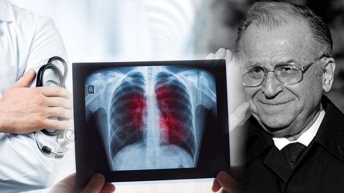 Care sunt simptomele cancerului la plămâni, boala care l-a ucis pe Ion Iliescu
