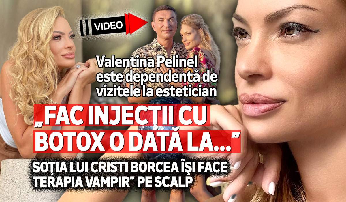 Valentina Pelinel este dependentă de vizitele la estetician. „Fac injecţii cu botox o dată la...” Soţia lui Cristi Borcea îşi face „terapia vampir” pe scalp