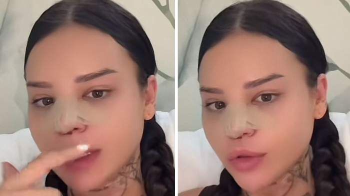 Diandra Doris, fosta ispită de la Insula Iubirii, pe mâna esteticianului! La ce intervenție a apelat
